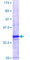 ab153649 on a 12.5% SDS-PAGE stained with Coomassie Blue.