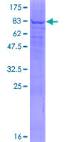 ab160016 on a 12.5% SDS-PAGE stained with Coomassie Blue.