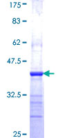 ab160017 on a 12.5% SDS-PAGE stained with Coomassie Blue.