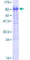 ab165864 on a 12.5% SDS-PAGE stained with Coomassie Blue.