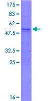 ab161623 on a 12.5% SDS-PAGE stained with Coomassie Blue.