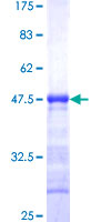 ab161624 on a 12.5% SDS-PAGE stained with Coomassie Blue.