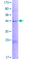 ab165420 on a 12.5% SDS-PAGE stained with Coomassie Blue.