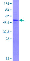 ab161829 on a 12.5% SDS-PAGE stained with Coomassie Blue.