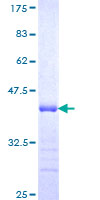 ab161830 on a 12.5% SDS-PAGE stained with Coomassie Blue.