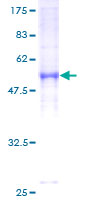 ab159190 on a 12.5% SDS-PAGE stained with Coomassie Blue.