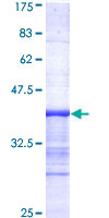 ab159191 on a 12.5% SDS-PAGE stained with Coomassie Blue.