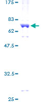 ab159192 on a 12.5% SDS-PAGE stained with Coomassie Blue.