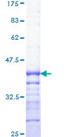 ab159197 on a 12.5% SDS-PAGE stained with Coomassie Blue.