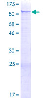 ab159198 on a 12.5% SDS-PAGE stained with Coomassie Blue.