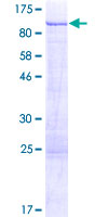 ab159199 on a 12.5% SDS-PAGE stained with Coomassie Blue.