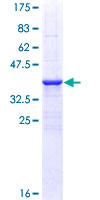 ab159200 on a 12.5% SDS-PAGE stained with Coomassie Blue.
