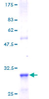 ab159202 on a 12.5% SDS-PAGE stained with Coomassie Blue.