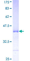ab159203 on a 12.5% SDS-PAGE stained with Coomassie Blue.