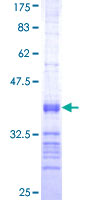 ab159201 on a 12.5% SDS-PAGE stained with Coomassie Blue.