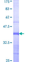ab161750 on a 12.5% SDS-PAGE stained with Coomassie Blue.