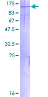 ab162277 on a 12.5% SDS-PAGE stained with Coomassie Blue.
