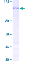 ab162278 on a 12.5% SDS-PAGE stained with Coomassie Blue.