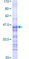 ab159208 on a 12.5% SDS-PAGE stained with Coomassie Blue.