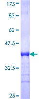 ab163747 on a 12.5% SDS-PAGE stained with Coomassie Blue.