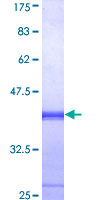 ab152636 on a 12.5% SDS-PAGE stained with Coomassie Blue.