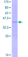ab164625 on a 12.5% SDS-PAGE stained with Coomassie Blue.