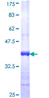 ab162339 on a 12.5% SDS-PAGE stained with Coomassie Blue.