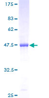 ab160109 on a 12.5% SDS-PAGE stained with Coomassie Blue.