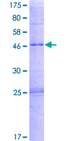 ab166147 on a 12.5% SDS-PAGE stained with Coomassie Blue.