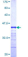 ab160058 on a 12.5% SDS-PAGE stained with Coomassie Blue.