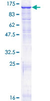 ab159139 on a 12.5% SDS-PAGE stained with Coomassie Blue.