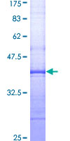 ab159140 on a 12.5% SDS-PAGE stained with Coomassie Blue.