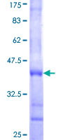 ab164992 on a 12.5% SDS-PAGE stained with Coomassie Blue.