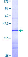ab163075 on a 12.5% SDS-PAGE stained with Coomassie Blue.