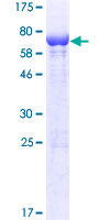 ab163705 on a 12.5% SDS-PAGE stained with Coomassie Blue.