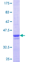 ab163706 on a 12.5% SDS-PAGE stained with Coomassie Blue.