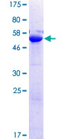 ab164068 on a 12.5% SDS-PAGE stained with Coomassie Blue.