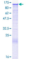 ab163896 on a 12.5% SDS-PAGE stained with Coomassie Blue.
