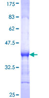 ab163551 on a 12.5% SDS-PAGE stained with Coomassie Blue.