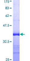 ab160680 on a 12.5% SDS-PAGE stained with Coomassie Blue.