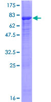 ab161570 on a 12.5% SDS-PAGE stained with Coomassie Blue.