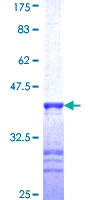 ab164245 on a 12.5% SDS-PAGE stained with Coomassie Blue.