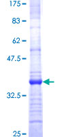 ab159141 on a 12.5% SDS-PAGE stained with Coomassie Blue.