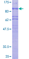 ab153125 on a 12.5% SDS-PAGE stained with Coomassie Blue.