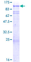 ab153126 on a 12.5% SDS-PAGE stained with Coomassie Blue.