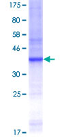 ab153127 on a 12.5% SDS-PAGE stained with Coomassie Blue.