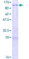 ab158149 on a 12.5% SDS-PAGE stained with Coomassie Blue.