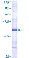 ab153121 on a 12.5% SDS-PAGE stained with Coomassie Blue.