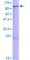 ab159142 on a 12.5% SDS-PAGE stained with Coomassie Blue.