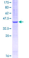 ab159143 on a 12.5% SDS-PAGE stained with Coomassie Blue.